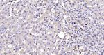 Ki-67 Antibody in Immunohistochemistry (Paraffin) (IHC (P))
