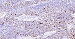 Ki-67 Antibody in Immunohistochemistry (Paraffin) (IHC (P))