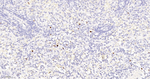 Ki-67 Antibody in Immunohistochemistry (Paraffin) (IHC (P))