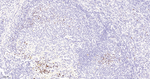 Ki-67 Antibody in Immunohistochemistry (Paraffin) (IHC (P))