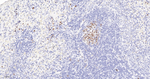 Ki-67 Antibody in Immunohistochemistry (Paraffin) (IHC (P))