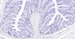 Ki-67 Antibody in Immunohistochemistry (Paraffin) (IHC (P))