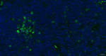 Ki-67 Antibody in Immunohistochemistry (Paraffin) (IHC (P))
