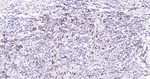 Ki-67 Antibody in Immunohistochemistry (Paraffin) (IHC (P))