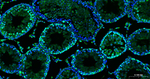 Ki-67 Antibody in Immunohistochemistry (Paraffin) (IHC (P))