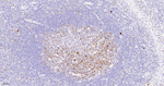 Ki-67 Antibody in Immunohistochemistry (Paraffin) (IHC (P))