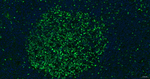 Ki-67 Antibody in Immunohistochemistry (Paraffin) (IHC (P))