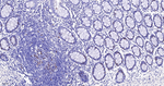 Ki-67 Antibody in Immunohistochemistry (Paraffin) (IHC (P))