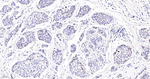 Ki-67 Antibody in Immunohistochemistry (Paraffin) (IHC (P))