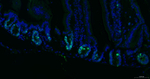 Ki-67 Antibody in Immunohistochemistry (Paraffin) (IHC (P))