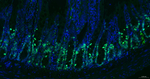 Ki-67 Antibody in Immunohistochemistry (Paraffin) (IHC (P))