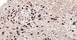 ATP Citrate Lyase Antibody in Immunohistochemistry (Paraffin) (IHC (P))