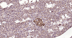 ATP Citrate Lyase Antibody in Immunohistochemistry (Paraffin) (IHC (P))