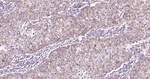 ATP Citrate Lyase Antibody in Immunohistochemistry (Paraffin) (IHC (P))