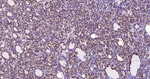 ATP Citrate Lyase Antibody in Immunohistochemistry (Paraffin) (IHC (P))