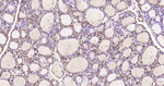 ATP Citrate Lyase Antibody in Immunohistochemistry (Paraffin) (IHC (P))