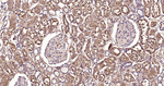 ATP Citrate Lyase Antibody in Immunohistochemistry (Paraffin) (IHC (P))