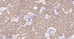 ATP Citrate Lyase Antibody in Immunohistochemistry (Paraffin) (IHC (P))
