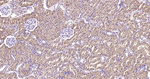 ATP Citrate Lyase Antibody in Immunohistochemistry (Paraffin) (IHC (P))