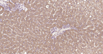 ATP Citrate Lyase Antibody in Immunohistochemistry (Paraffin) (IHC (P))