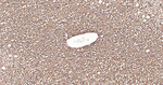 ATP Citrate Lyase Antibody in Immunohistochemistry (Paraffin) (IHC (P))
