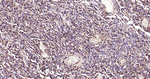 ATP Citrate Lyase Antibody in Immunohistochemistry (Paraffin) (IHC (P))