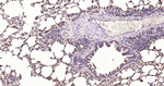 ATP Citrate Lyase Antibody in Immunohistochemistry (Paraffin) (IHC (P))