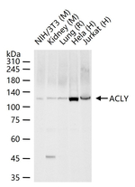 ATP Citrate Lyase Antibody in Western Blot (WB)