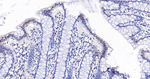 Phospho-JNK1/JNK2/JNK3 (Thr183, Thr221) Antibody in Immunohistochemistry (Paraffin) (IHC (P))