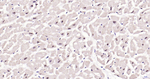Phospho-JNK1/JNK2/JNK3 (Thr183, Thr221) Antibody in Immunohistochemistry (Paraffin) (IHC (P))