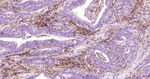 ICAM-1 Antibody in Immunohistochemistry (Paraffin) (IHC (P))