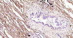 ICAM-1 Antibody in Immunohistochemistry (Paraffin) (IHC (P))