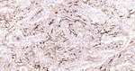 ICAM-1 Antibody in Immunohistochemistry (Paraffin) (IHC (P))