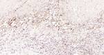 ICAM-1 Antibody in Immunohistochemistry (Paraffin) (IHC (P))
