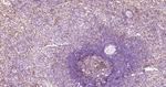 ICAM-1 Antibody in Immunohistochemistry (Paraffin) (IHC (P))
