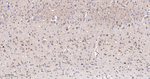 SGK1 Recombinant Rabbit Monoclonal Antibody (6D1)