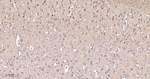 SGK1 Antibody in Immunohistochemistry (Paraffin) (IHC (P))