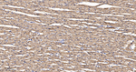 SGK1 Antibody in Immunohistochemistry (Paraffin) (IHC (P))