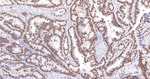Ku80 Antibody in Immunohistochemistry (Paraffin) (IHC (P))