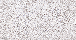Ku80 Antibody in Immunohistochemistry (Paraffin) (IHC (P))