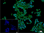 TOP1 Recombinant Rabbit Monoclonal Antibody (1D1)