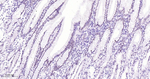 TOP1 Antibody in Immunohistochemistry (Paraffin) (IHC (P))