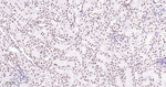TOP1 Antibody in Immunohistochemistry (Paraffin) (IHC (P))