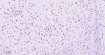 TOP1 Antibody in Immunohistochemistry (Paraffin) (IHC (P))