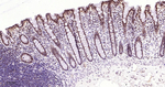 TOP1 Antibody in Immunohistochemistry (Paraffin) (IHC (P))
