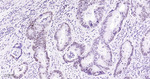 TOP1 Antibody in Immunohistochemistry (Paraffin) (IHC (P))