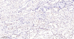 TOP1 Antibody in Immunohistochemistry (Paraffin) (IHC (P))