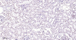 TOP1 Antibody in Immunohistochemistry (Paraffin) (IHC (P))