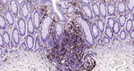 HLA-DR Antibody in Immunohistochemistry (Paraffin) (IHC (P))