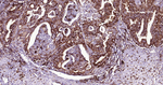 HLA-DR Antibody in Immunohistochemistry (Paraffin) (IHC (P))
